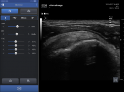 SONON Ultrasound App screenshot 1