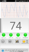 تشخيص القلب (معدل ضربات القلب، انتظام ضربات القلب) screenshot 5