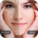 Face Blemish Remover - Smooth Skin & Beautify Face Icon