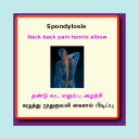 Spondylosis Spondylitis Icon