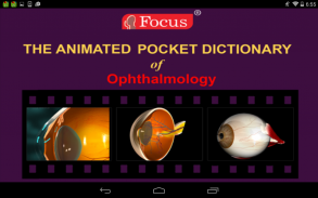 Ophthalmology -Pocket Dict. screenshot 5