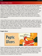 Peptic Ulcers Help & Diet Tips screenshot 3