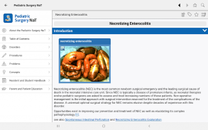 APSA Pediatric Surgery Library screenshot 1