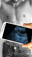 Ultrasound Scanner Prank screenshot 2