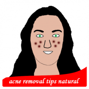 acne removal tips natural screenshot 8