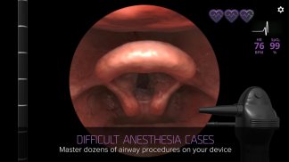 Airway Ex: Sharpen Your Intubation Skills screenshot 3