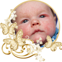 Eczema in Children Remedies