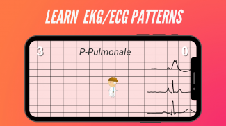 ECG Run - gamify ECG learning and EKG training screenshot 1