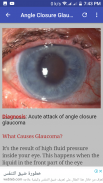 Ophthalmology & Optometry Guide screenshot 5