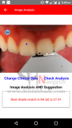 Dental Shade Navigator screenshot 6