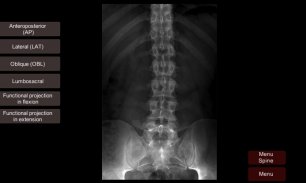 Radiographic Anatomy X-Ray screenshot 3
