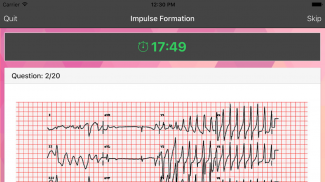 ECG Master: Quiz & Explanation screenshot 1