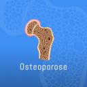 Osteoporose