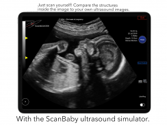 ScanBaby learn baby ultrasound screenshot 3