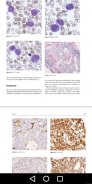 Haematology - Hematology &100+ Worked Practicals screenshot 4