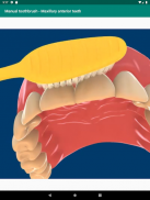 Dental diagnosis & patient education aid - Dentalk screenshot 4