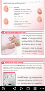 Breast Cancer Survival Guide for Patients screenshot 3