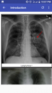 Chest X-Ray Based Cases screenshot 5