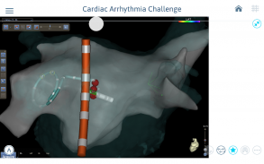 Cardiac Arrhythmia Challenge screenshot 4