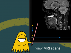 icompanion: understand your MS screenshot 3