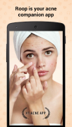 Roop - How to get rid of acne? screenshot 1