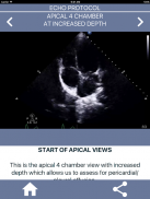 LEARN FULL ECHO TTE PROTOCOL screenshot 3