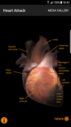CardioSmart Heart Explorer screenshot 3