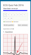 Diagnose ECG screenshot 2