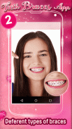 Teeth Braces App 2 screenshot 2