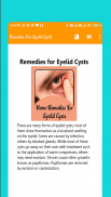 Remedies For Eyelid Cysts screenshot 2