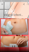 Vaginal infections screenshot 3