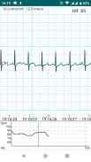 DiaCard - ECG Recorder screenshot 14