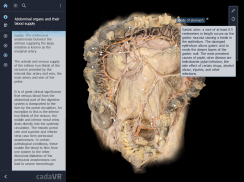 cadaVR anatomy screenshot 7