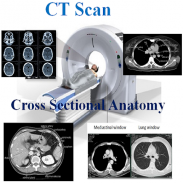 CT Scan Cross Sectional Anatomy screenshot 2