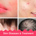 Skin Diseases and Treatments