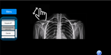 Radiographic Anatomy X-Ray screenshot 6
