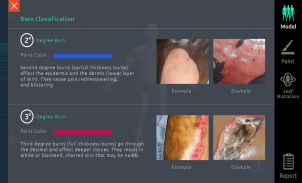 3D Burn Resuscitation screenshot 2