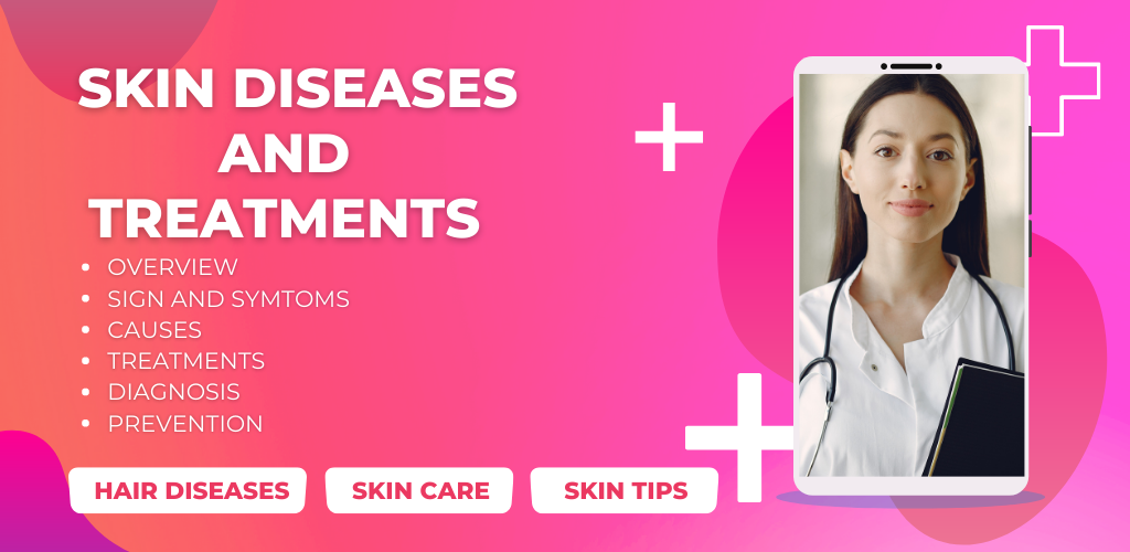 Skin Diseases and Treatments - APK Download for Android | Aptoide