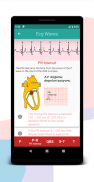 ECG Learning interpretation screenshot 2