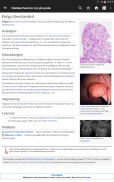 Wikipedia Medizin (Offline) screenshot 1