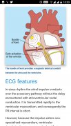 ECG Basics - Learning and interpretation made easy screenshot 1