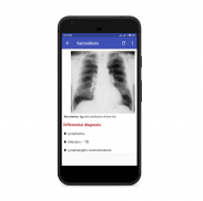 Chest Radiology screenshot 1