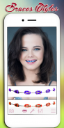 Braces Photo Editor screenshot 6