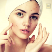Skin and Face Care - acne, fairness, wrinkles screenshot 8