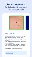 AI Dermatologist: Skin Scanner screenshot 1