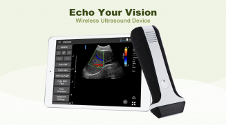 LELTEK Ultrasound - LeSono screenshot 2