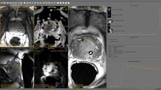 Symmetry DICOM screenshot 8