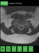 MRI Viewer screenshot 8