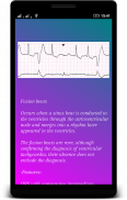 ECG (EKG) Interpretación screenshot 1
