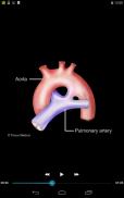 Cardiology-Animated Dictionary screenshot 10